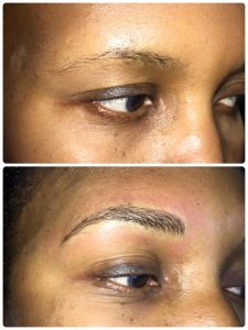 Microblading Before and After Photo